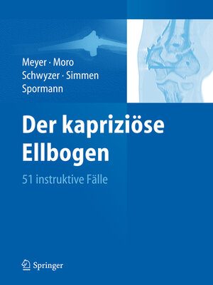 cover image of Der kapriziöse Ellbogen